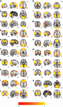 Resting-state networks (RSNs) from the independent component analysis (ICA) group decomposition.